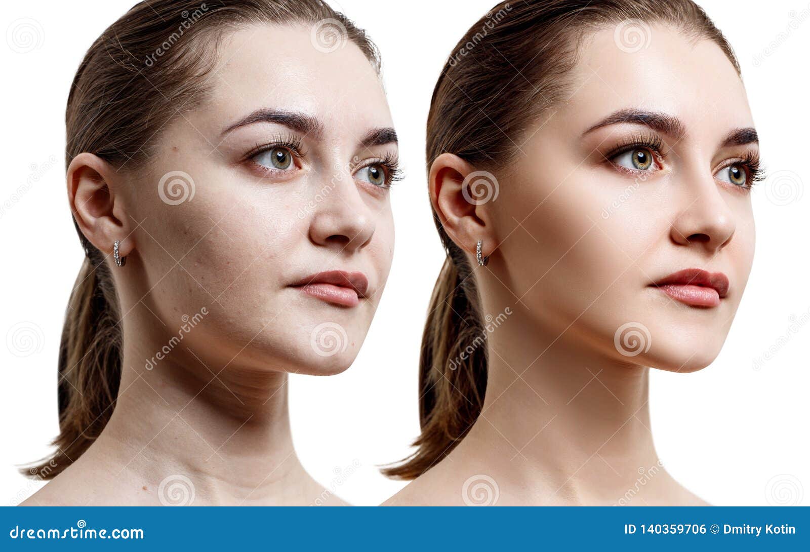 Before and after portrait of woman Retouched